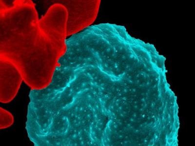 Malaria-infected red blood cell