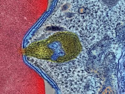 Malaria parasite attaching to human blood cell