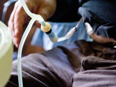 Man undergoing dialysis