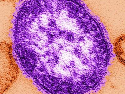 Measles virion