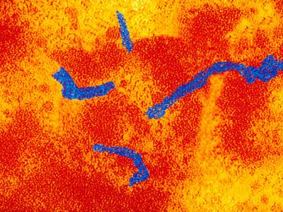 Measles virus