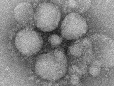 CDC electron microscope image of MERS-CoV