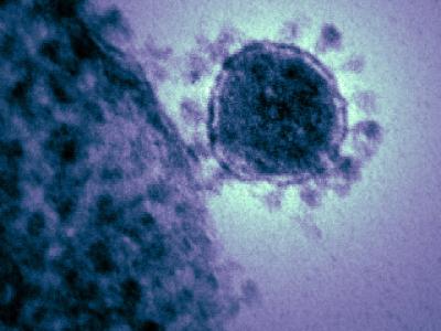 Micrograph of MERS virus
