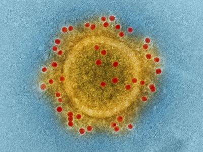 MERS virus