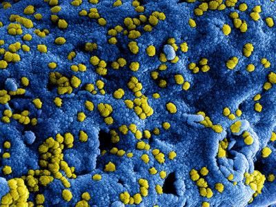 MERS-CoV particles