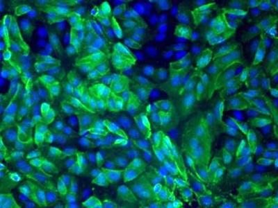 MERS-infected vero cells