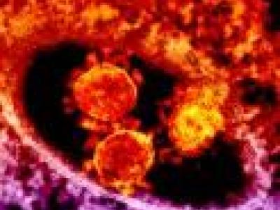 MERS-CoV micrograph
