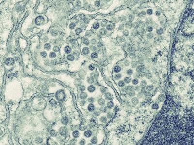 An electron micrograph of a thin section of MERS-CoV, showing the spherical particles and cross-sections through the viral nucleocapsid.
