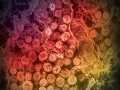 MERS-CoV in cytoplasm