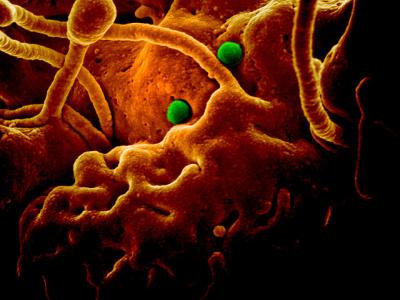MERS-CoV