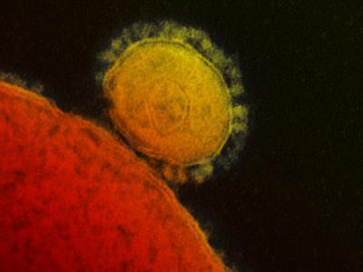 Transmission electron micrograph of Middle East Respiratory Syndrome Coronavirus