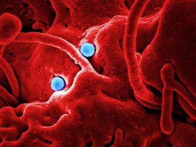 MERS particle