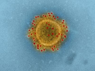 MERS coronavirus