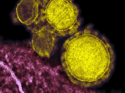 MERS virus