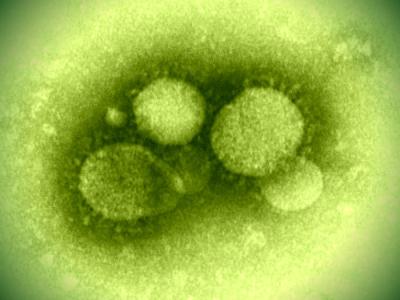 MERS virus