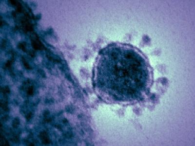 MERS virus