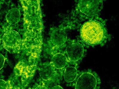 MERS virus