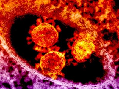 MERS virus