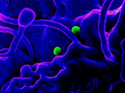 MERS virus particles