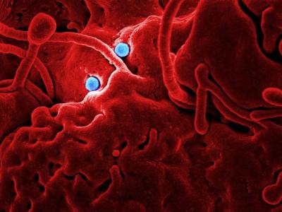 MERS virus particles