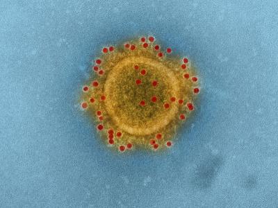 MERS virus