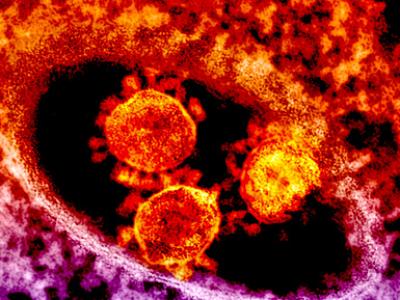 MERS virus