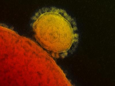 MERS virus