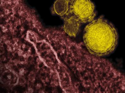 MERS virus