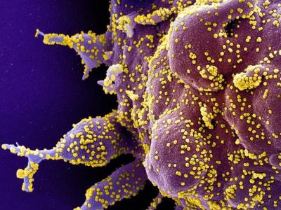 SARS-CoV-2 highly magnified