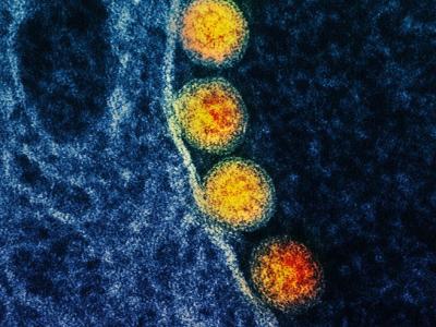 COVID-19 viruses under the microscope