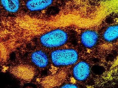 Monkeypox viruses under the microscope