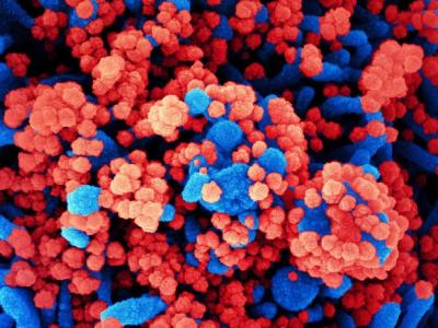 Magnified view of COVID-19 viruses