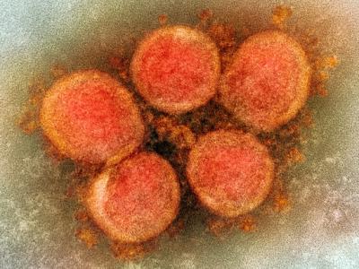 Microscope view of SARS-CoV-2 viruses