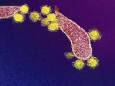SARS-CoV-2 viruses under the microscope