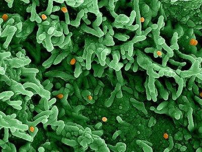 Monkeypox virus infecting cells
