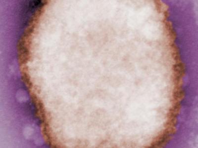 Monkeypox virus under microscope
