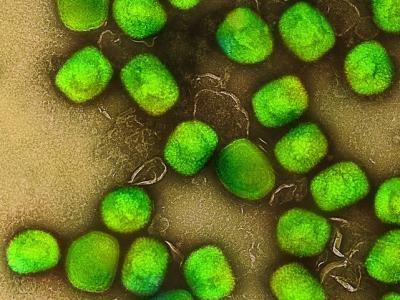 Monkeypox viruses highly magnified
