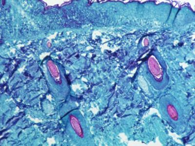 Monkeypox viruses under the microscope