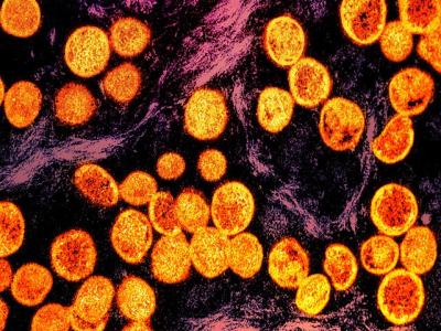 Monkeypox viruses under the microscope