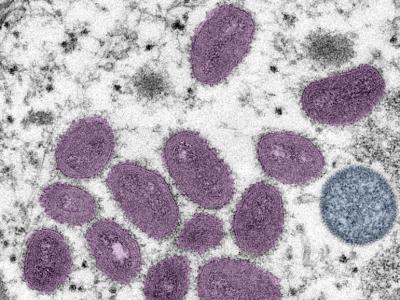 Monkeypox viruses under the microscope