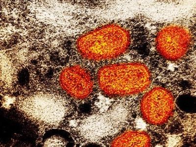 Monkeypox viruses under the microscope
