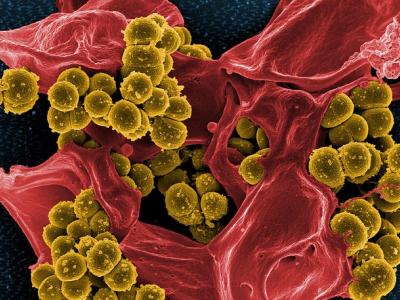 MRSA