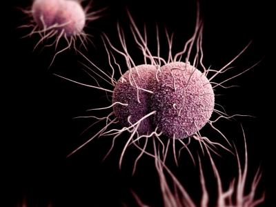 Gonorrhea