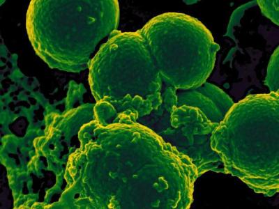 Neutrophil ingesting MRSA