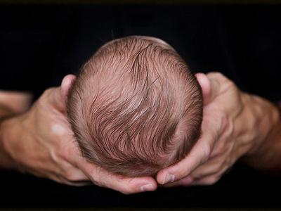 Newborn head