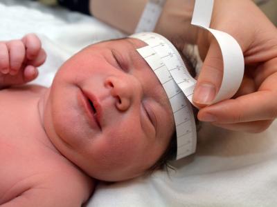 Baby head circumference