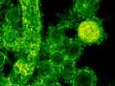 MERS-CoV micrograph