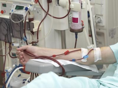 Patient getting dialysis treatment