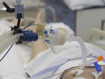 Patient on ventilator