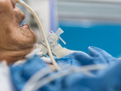 Patient on ventilator with tracheostomy